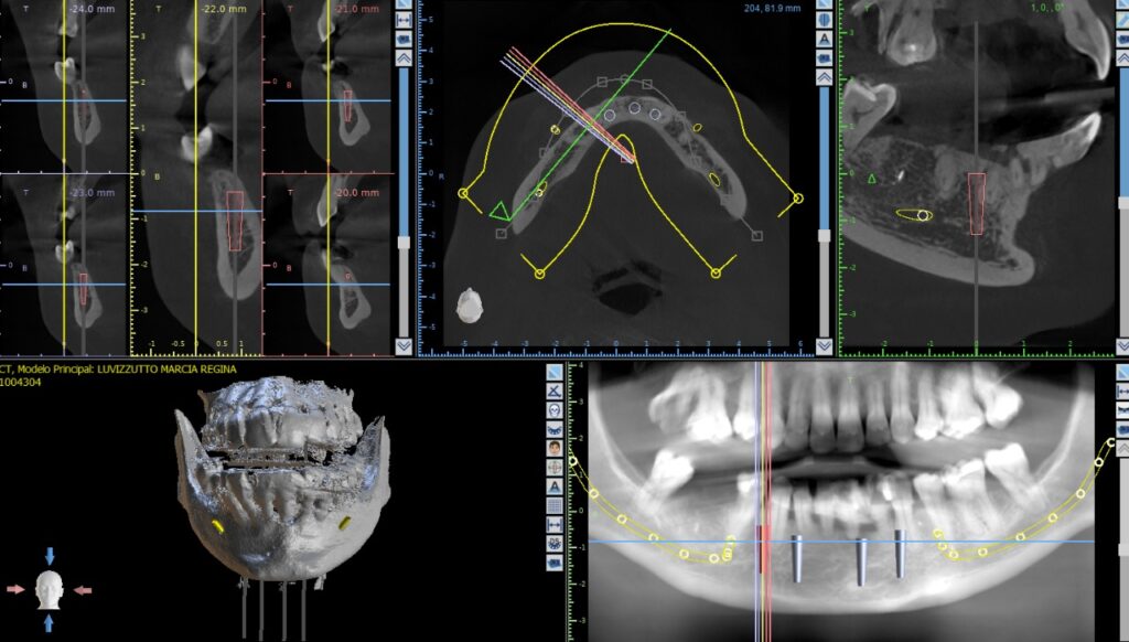 Paciente sorrindo após tratamento odontológico