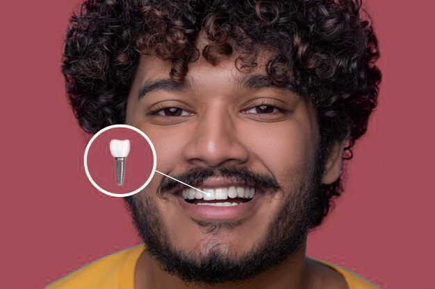 Jovem sorrindo após tratamento de implante dentário
